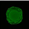 view-aligned slices with MIP