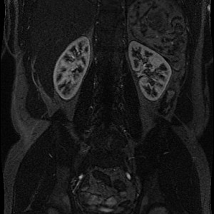 Abdomen-post Abdomen-post