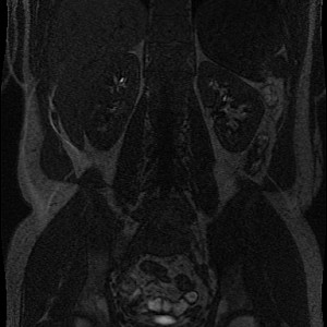 Abdomen-pre Abdomen-pre