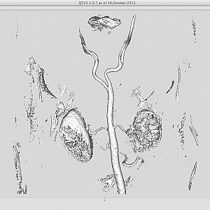 Angio-IsoSurface