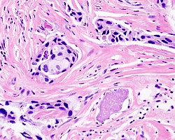 BreastStaining2