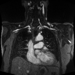 Heart-MIPt