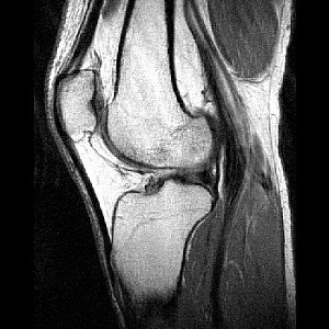 MR Imaging