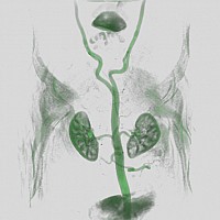 with thresholding with thresholding