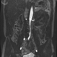without thresholding without thresholding