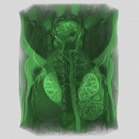 without thresholding without thresholding