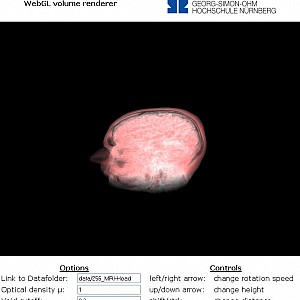 MRI-Head1