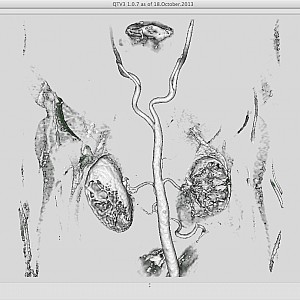 Angio-IsoSurface